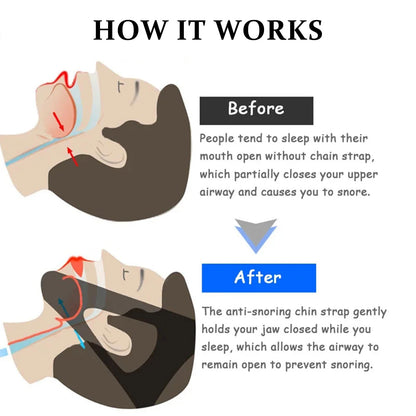 Boquilla Antironquidos Confortable